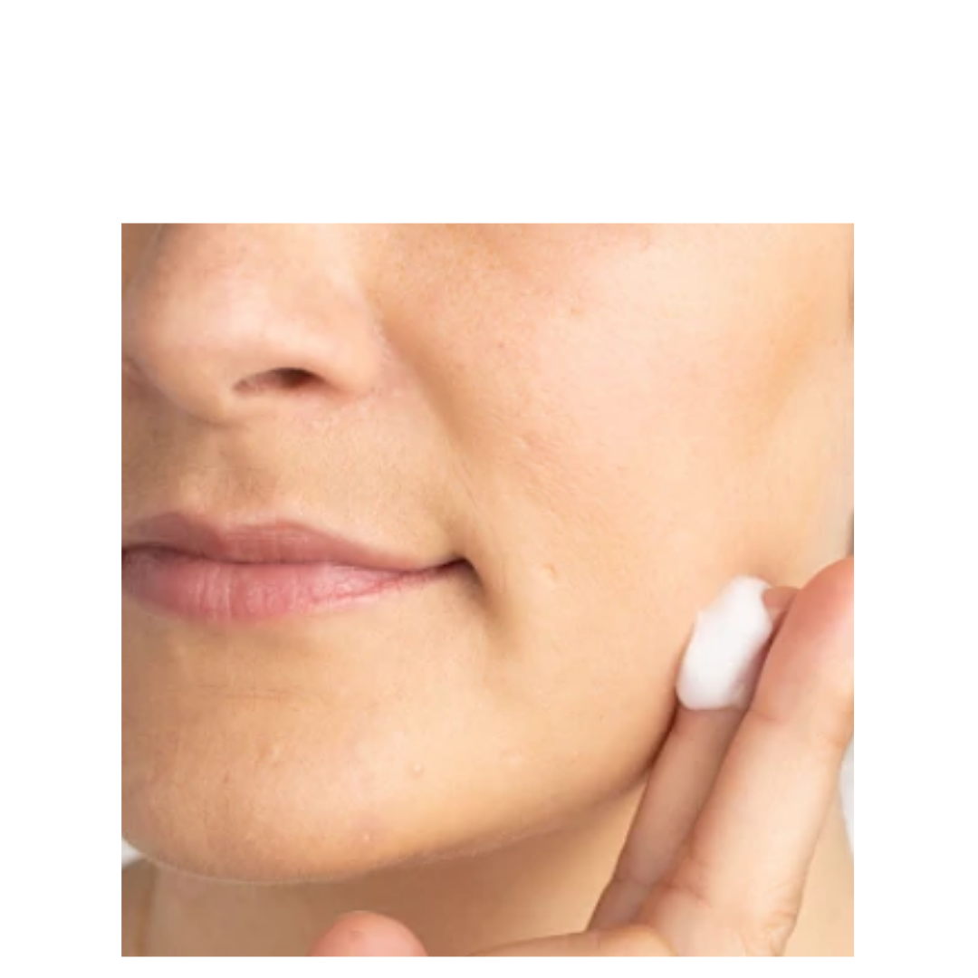 Face Reality 5% Acne Med