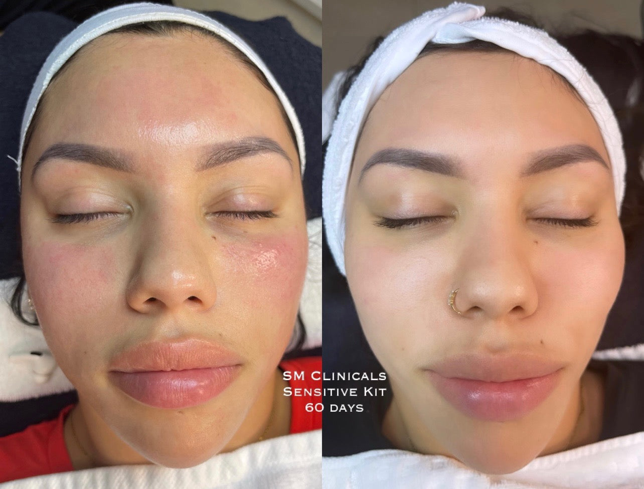 Sensitive Skin Kit