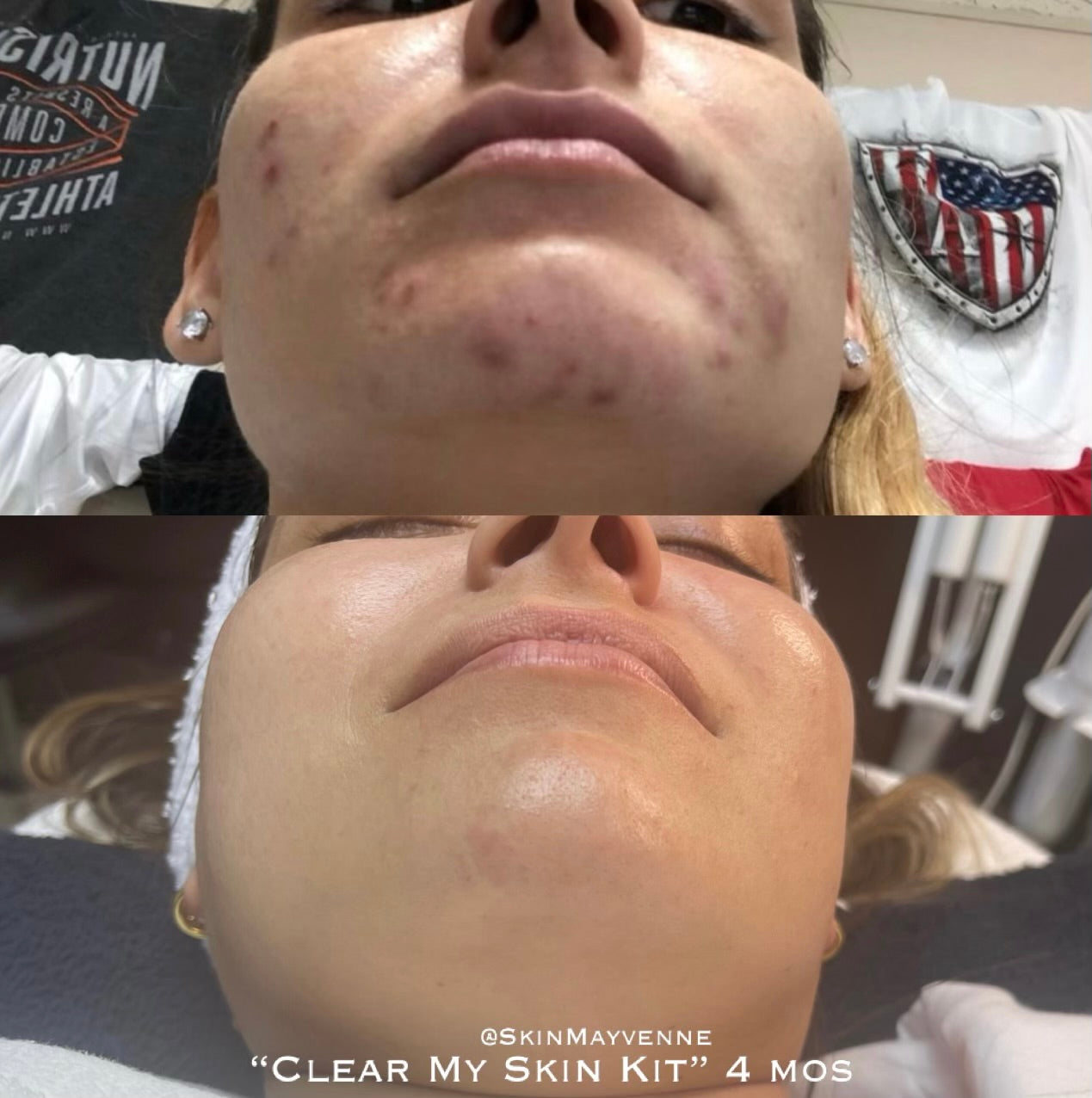 Clear My Skin Kit