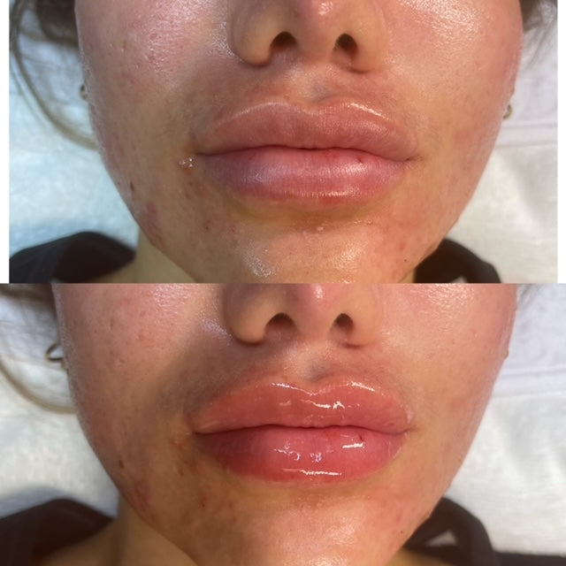 SM Clinicals Pure Pout Lip Plumper