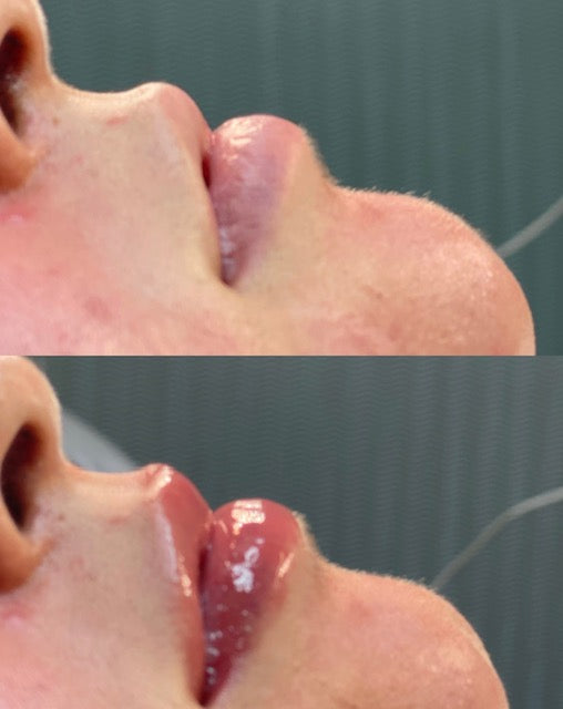 SM Clinicals Pure Pout Lip Plumper